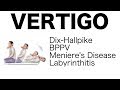 Vertigo (Different Types, Dix-Hallpike Maneuver, Treatment)