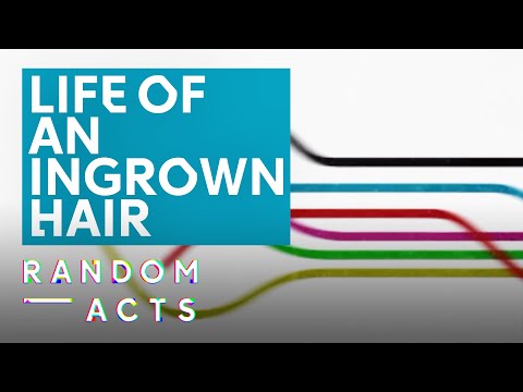Adventures of an ingrowing hair | Ingrowing Hair by Bunch | Animated short film | Random Acts