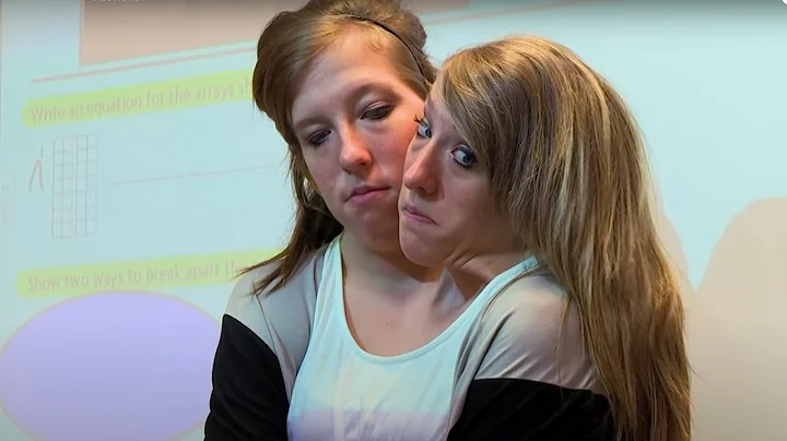 Abby and Brittany Hensel: The Conjoined Teachers!