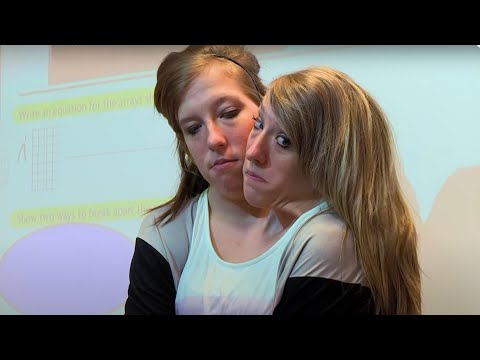 Abby and Brittany Hensel: The Conjoined Teachers!