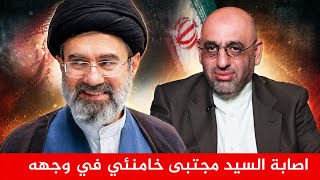 حقيقة تشوهات السيد مجتبى خامنئي في وجهه   تفاصيل يكشفها الاستاذ هادي دلول  سمعها