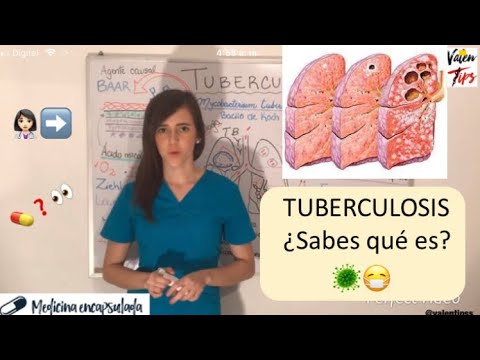 Vídeo: El Impacto En La Tuberculosis Incidente Por El Estado De Deterioro De La Función Renal: Análisis De La Relación De Gravedad