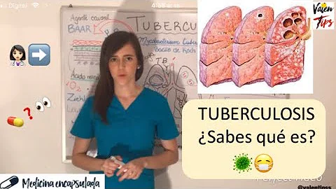 ¿Cuánto es el período de incubación de la tuberculosis?