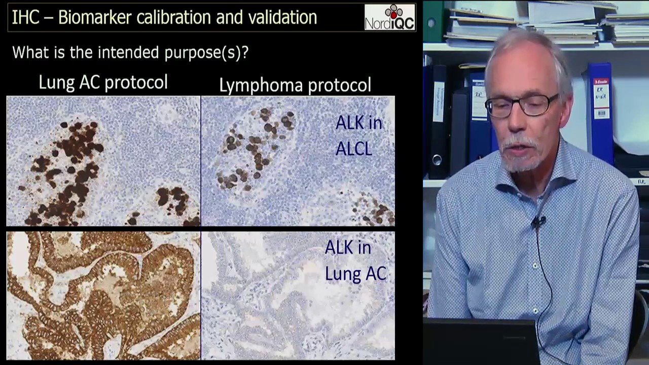 Prof. Mogens Vyberg on NordiQC and PD-L1