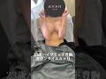 ハイブリッド豊胸ダウンタイム6ヶ月までのリアル!?#shorts