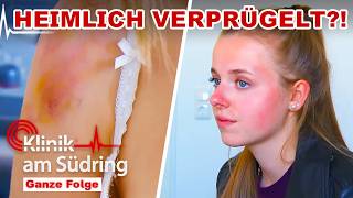 Download Lagu KNOTEN in der Brust \u0026 Körper voller blauer Flecken! Wer tut ihr das an? | Klinik am Südring | SAT.1 MP3