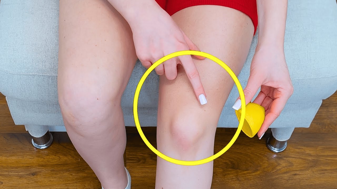 Reibe dein Knie mit Zitrone ein! Die Wirkung wird dich überraschen