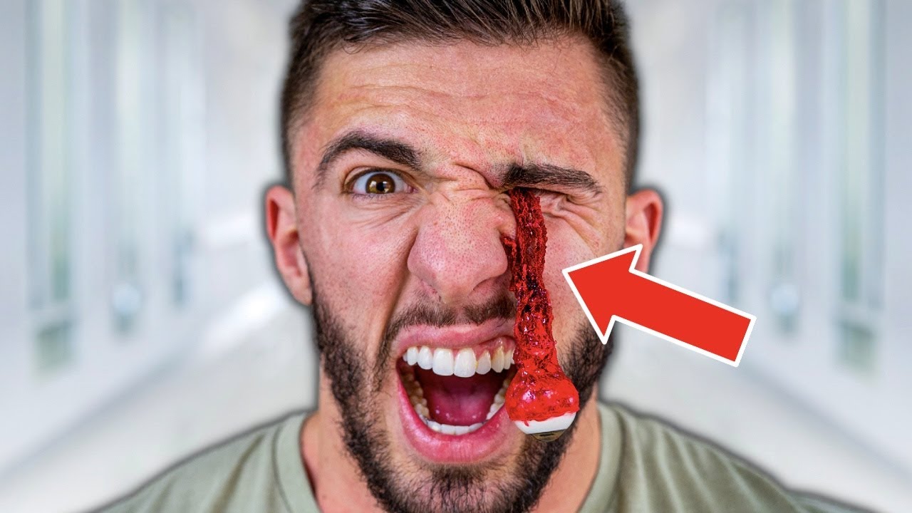 MY EYEBALL FELL OUT!