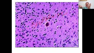 Amir Bio 2 Toxoplasma