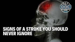 The Truth About Strokes: Myths, Warning Signs & Prevention | Ask The Doc