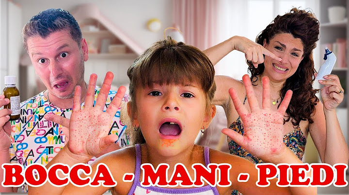 AURORA HA PRESO LA BOCCA MANI PIEDI E HA LE VESCICHE! #capitandadeaurora #videodifamiglia