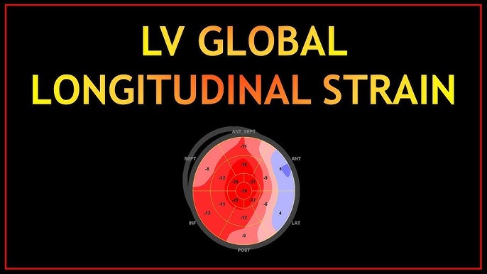 WHAT IS GLOBAL LONGITUDINAL STRAIN AND ITS CLINICAL IMPORTANCE? 