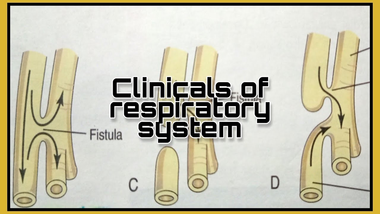 Clinicals of respiratory system | Respiratory embryology - YouTube