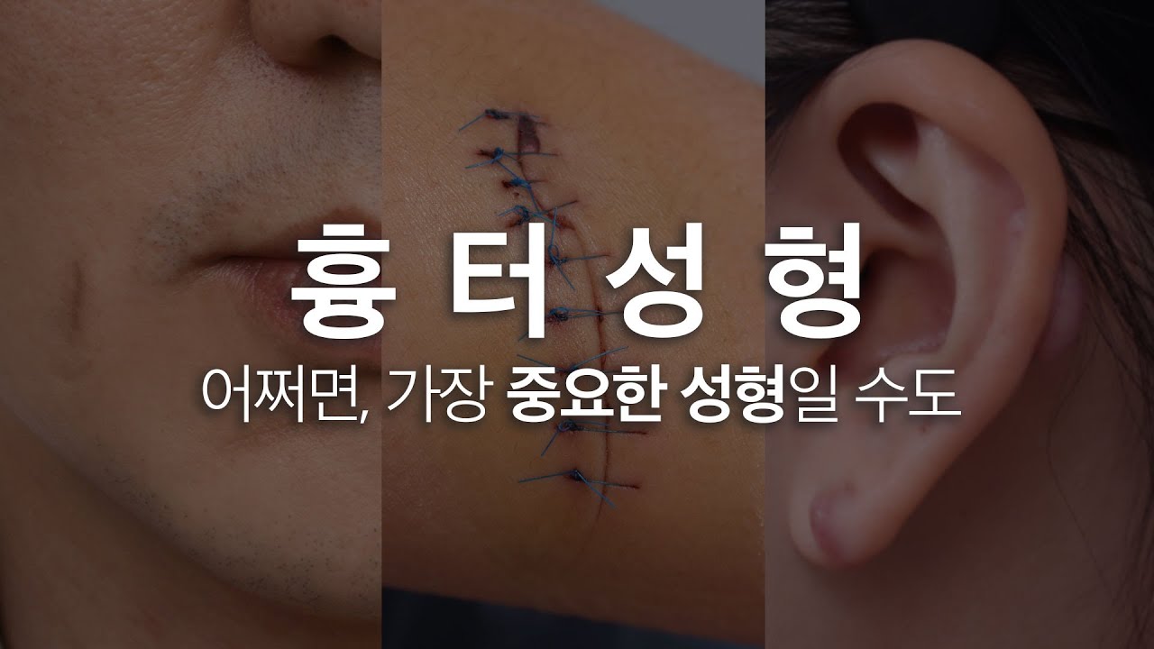 흉터?이제 걱정하지 마세요!😎흉터 성형으로 새롭게 태어나자!