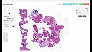 The Digital Pathology Platform By Crs4