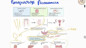 Preeklamsia Hipertensi Dalam Kehamilan - Patofisiologi, Diagnosis, Manajemen Persalinan dan Obat