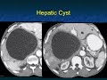 Ct evaluation of liver masses key differential diagnosis pathways  part 1