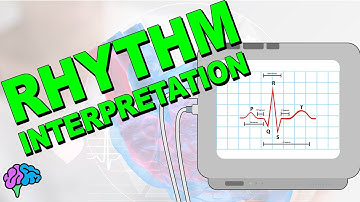 The Complete ECG Rhythm Interpretation Series!