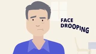 Act FAST with signs of a stroke