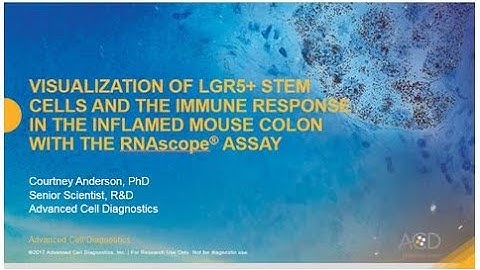 Visualization of LGR5+ Stem Cells and the immune response using RNAscope® Assay