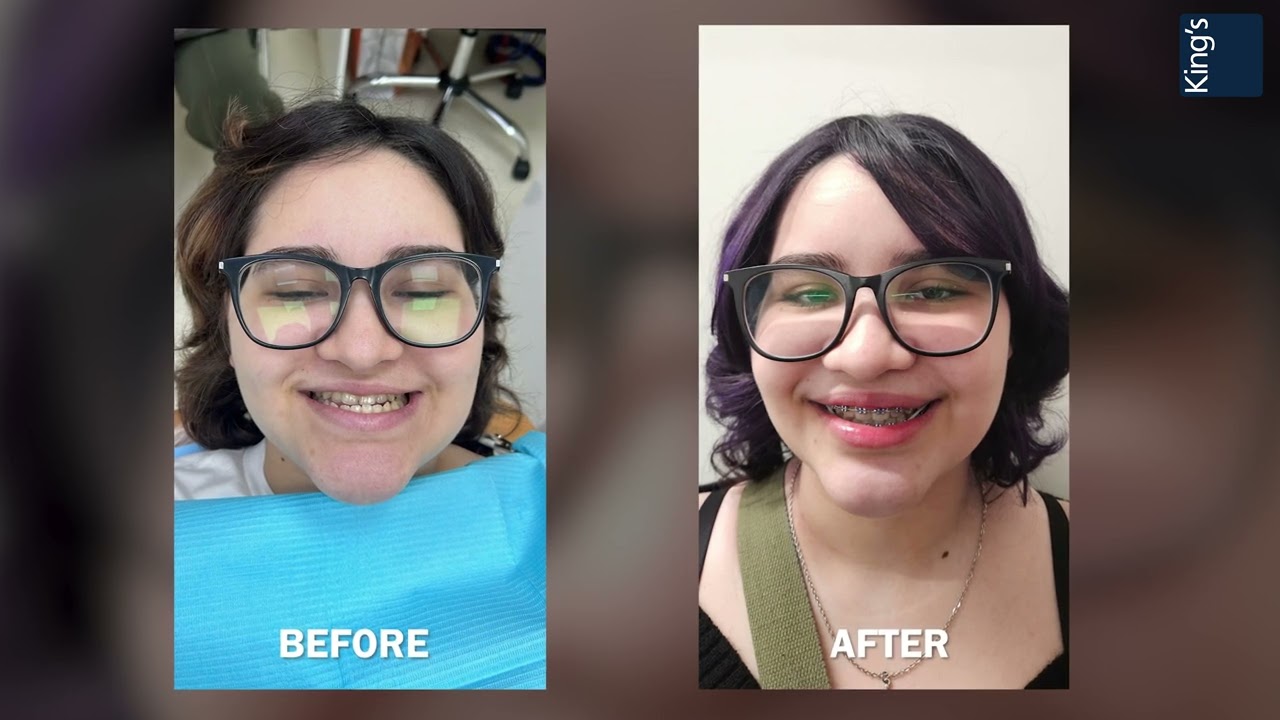 Oral and Maxillofacial Surgery | Dr Kartic Rajaram | King's College Hospital London - Dubai