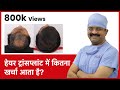 What Is The Cost Of Hair Transplant In India (हेयर ट्रांसप्लांट में कितना खर्चा आता है) | (In HINDI)