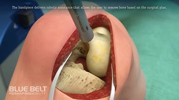 Blue Belt Technologies