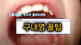 서울대 출신 약사가 알려 드려요. 구내염 빨리 낫는 방법