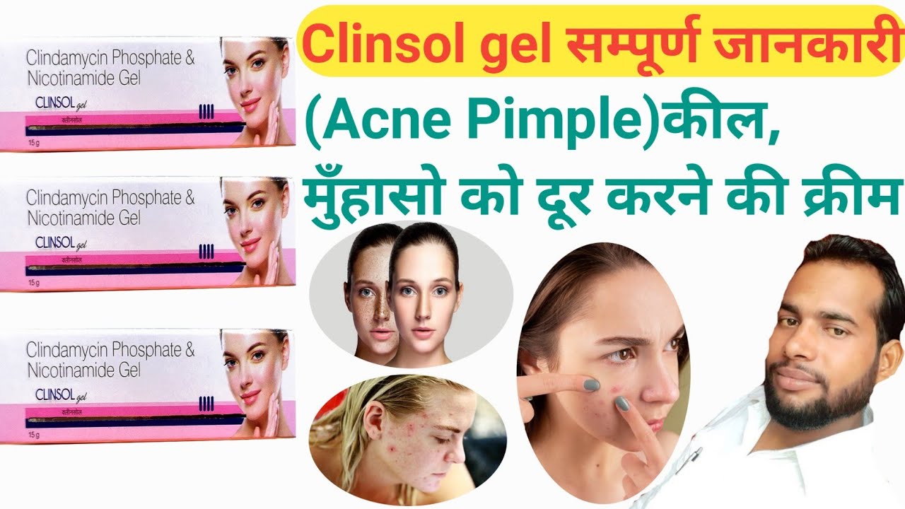 Clinsol gel Clinsol gel use in HindiClinsol gel review hindi