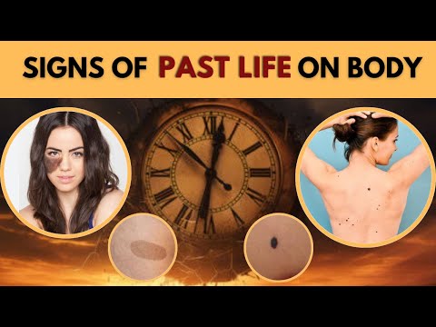 Signs Of Past Life Birth | Birth Mark | Punar Janam Ka Sach | Rebirth | Astrology | पूर्व जन्म