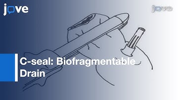 Biofragmentable Drain Protecting Stapled Colorectal Anastomosis From Leakage l Protocol Preview