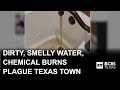 Dirty water, foul odor, chemical burn claims fuel outrage over troubled North Texas water system