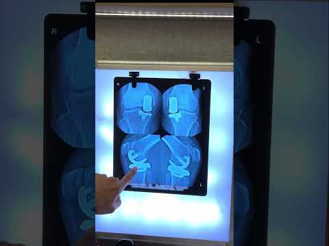 Https Youtu Be 76aWdOv6 Go Si PUtP4koDfkqGUs2N