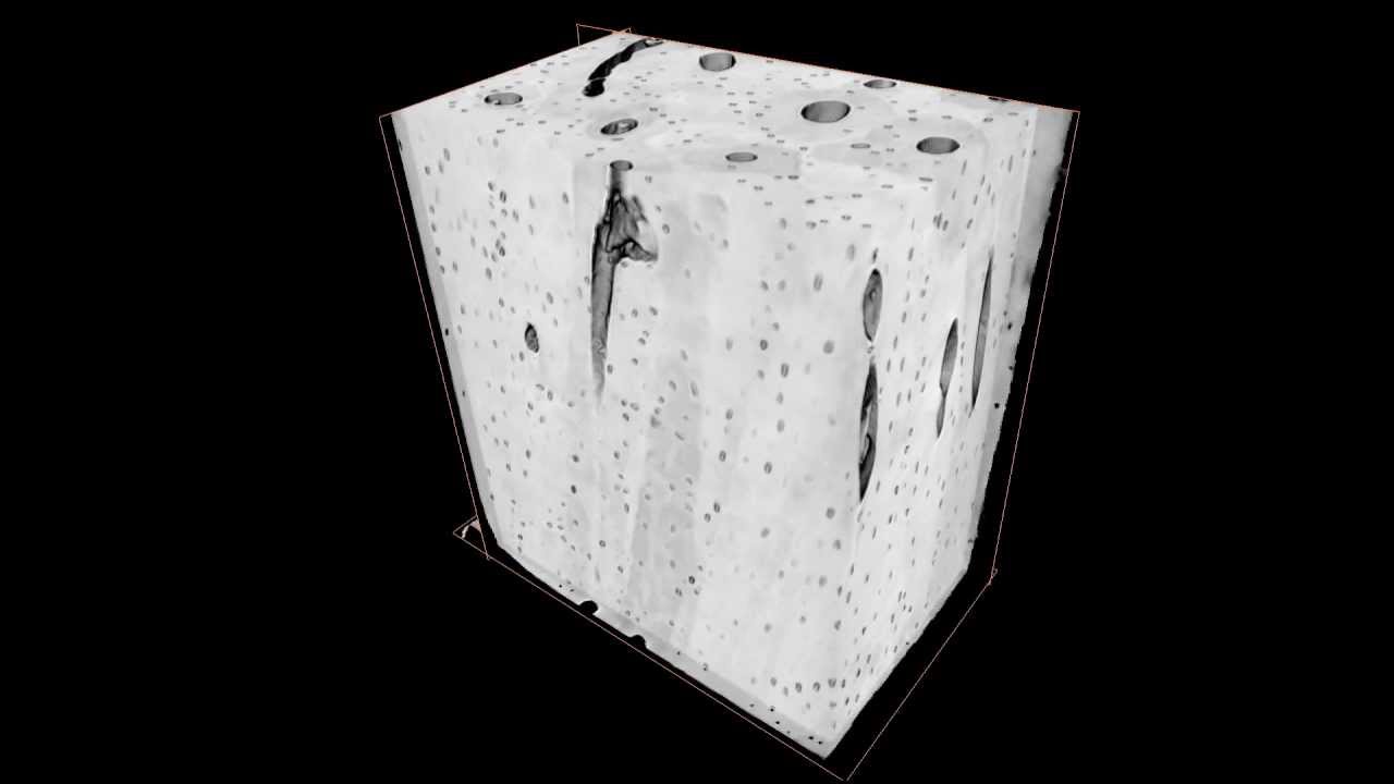 3D micron-scale imaging of healthy compact bone