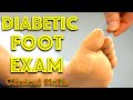 Diabetic foot examination  clinical skills  dr gill