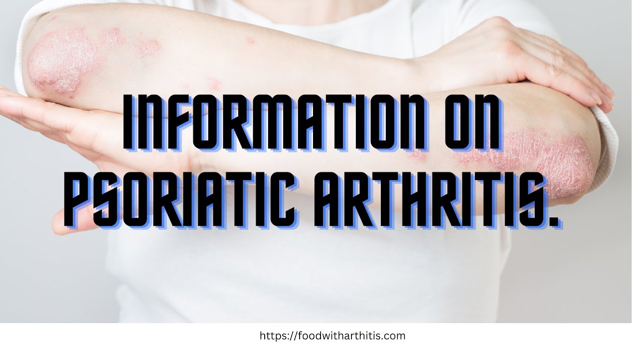 Information About Psoriatic Arthritis. YouTube