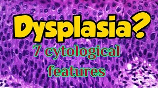 7cytological features of Dysplasia: Medschool Microvlog 8