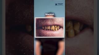 Can I Brush My Teeth With Chocolate?