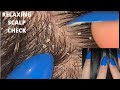 Asmr relaxing scalp check for sleep  zoom 5 scratching asmrsleep scalp