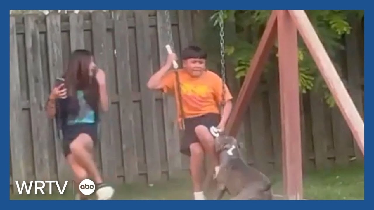 Family questions response time following dog attack - YouTube