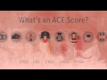 Aces Mp3 Mp4 Free download