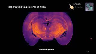 "Big Brains, Small Targets: Whole-Brain Image Analysis with Python" - Ishrat Zaman (PyCon AU 2025)