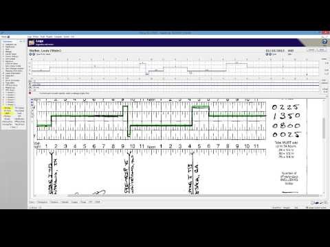 RapidLog LITE Processing (Pro Alternative)