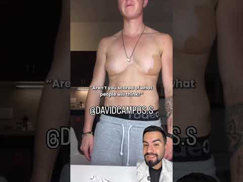 MASTECTOMIA MASCULINA #mastectomia