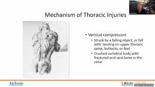 Spine Assessment: The 3-Column Spine