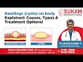 Swelling (Cysts) on the Body Explained Causes, Types and Treatment Options | Dr. Manoj Karthik