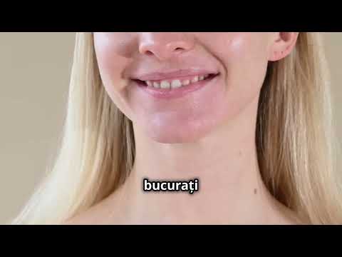 Implanturi All on 4 Intrebari si raspunsuri