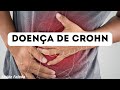 Doença de Crohn: Aprenda ouvindo