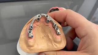 Byrnes Dental Lab Milled Bar and sleeve over denture