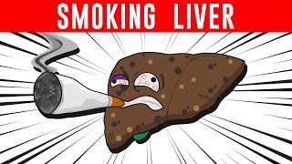 Does SMOKING affect your Liver Health